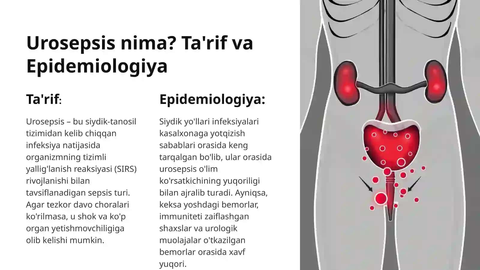 Urosepsis siydik-tanosil tizimi infeksiyasining og‘ir shakli 2