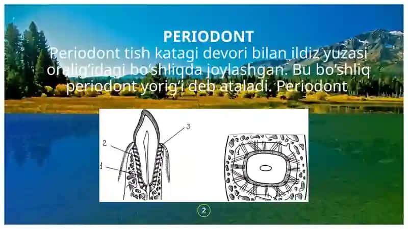 O`tkir Periodontitni patologik anatomiyasi 2