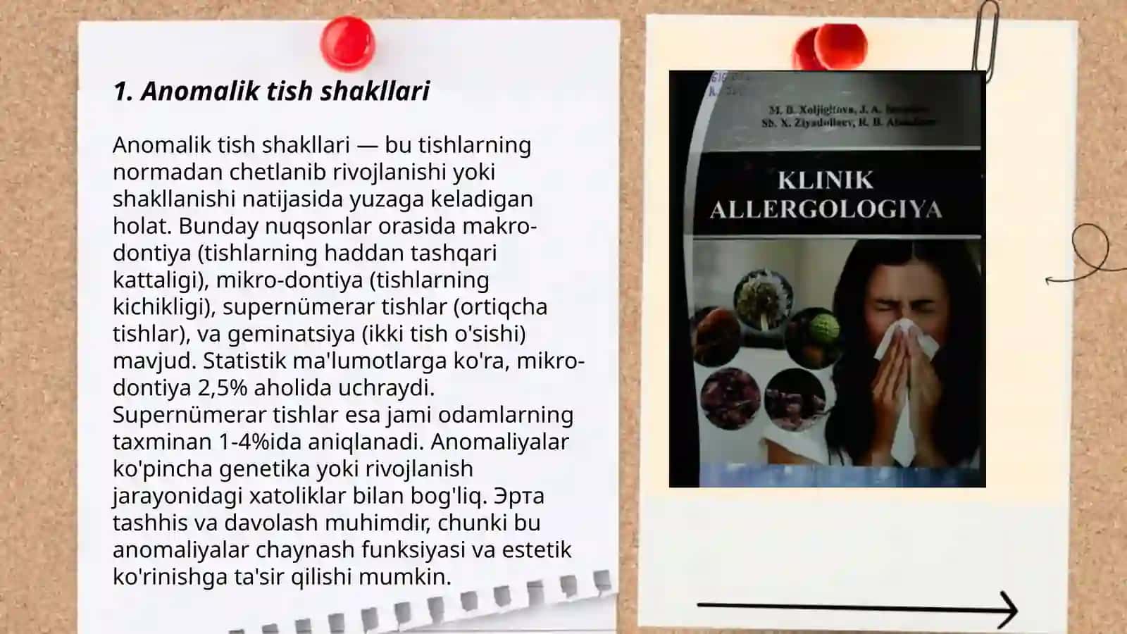 Tishlarning shakl, miqdor va holat anomaliyalari. Etiologiyasi patogenezi, klinikasi 3