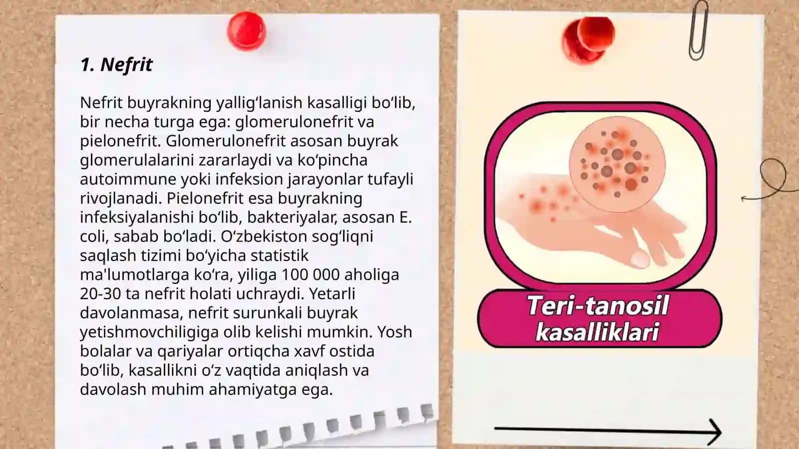 Siydik-tanosil tizimining kasalliklari 3