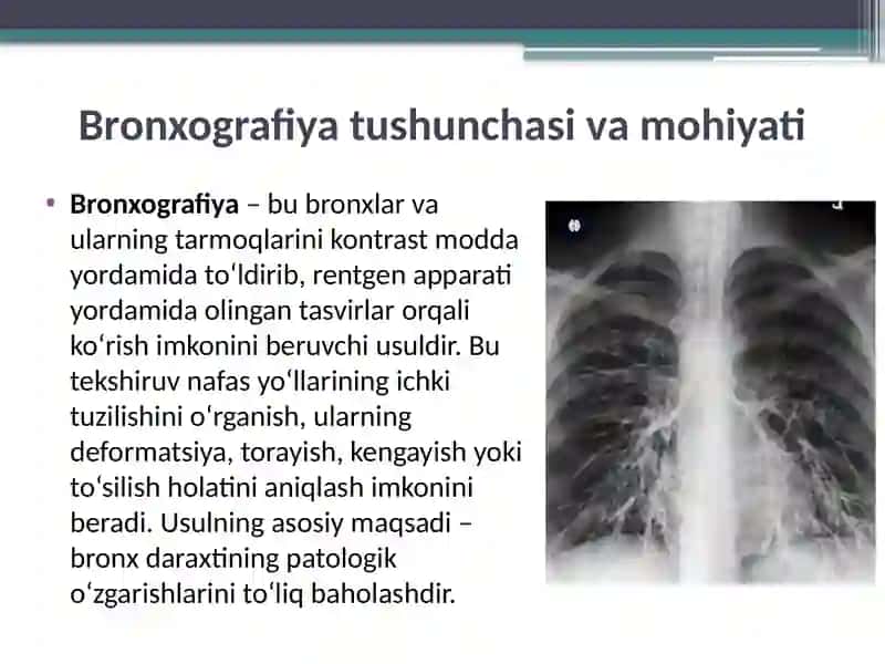 BRONXOGRAFIYA 3