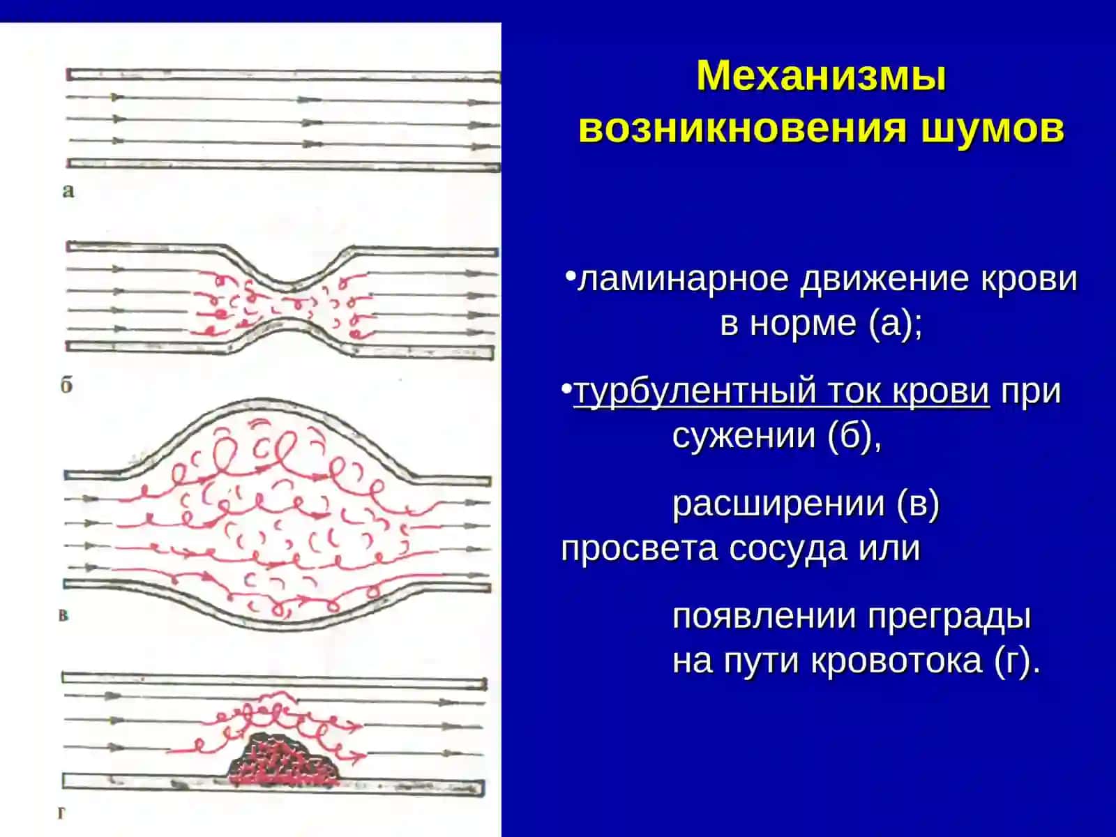 Шумы сердца 3