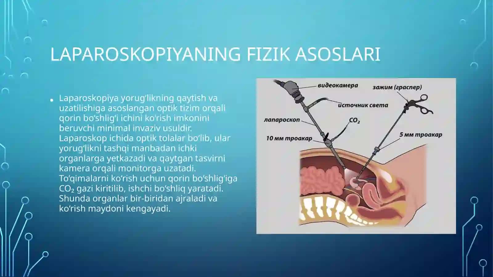 Biofizika - Laparoskopiyaning jarrohlikda qoʻllanilishi (11 slayd PPT)Fan: Biofizika
Mavzu: Laparosk 3