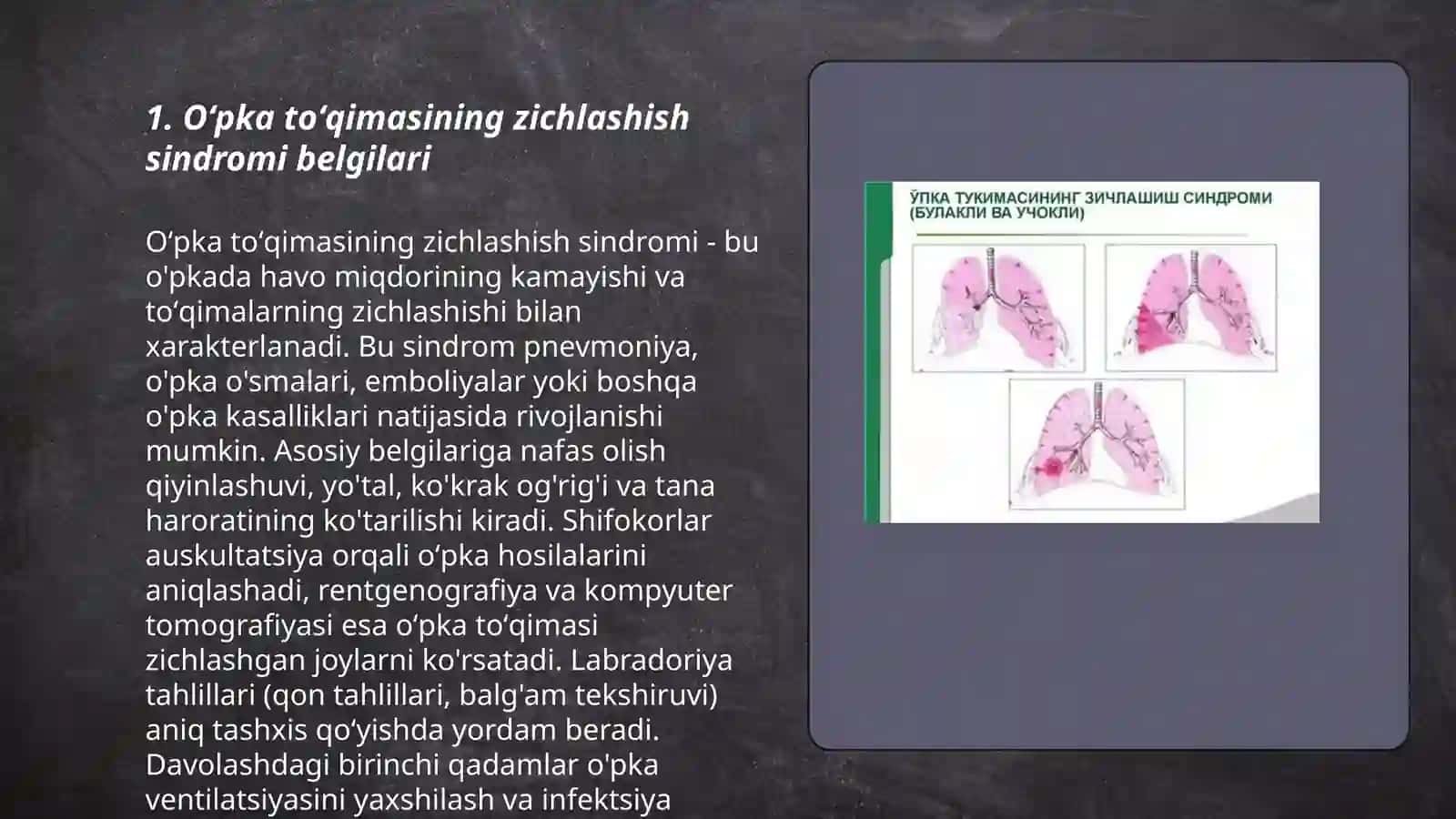 Oʻpka toʻqimasining zichlashish sindromi 3