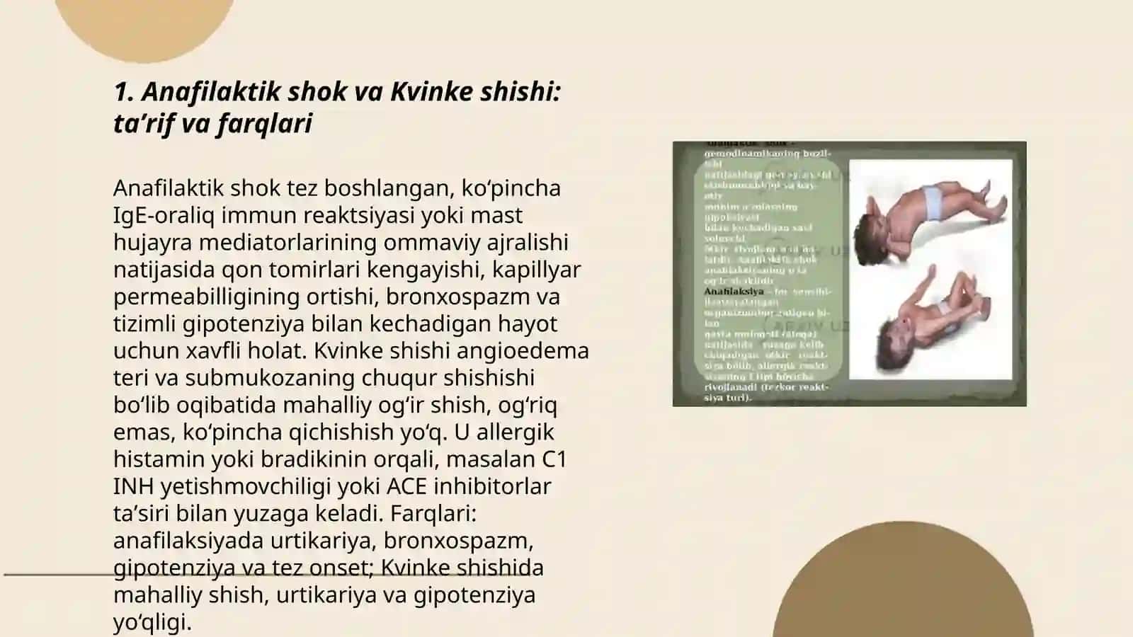 Anafilaktik shok va Kvinke shishi: taʼrif va farqlari 3
