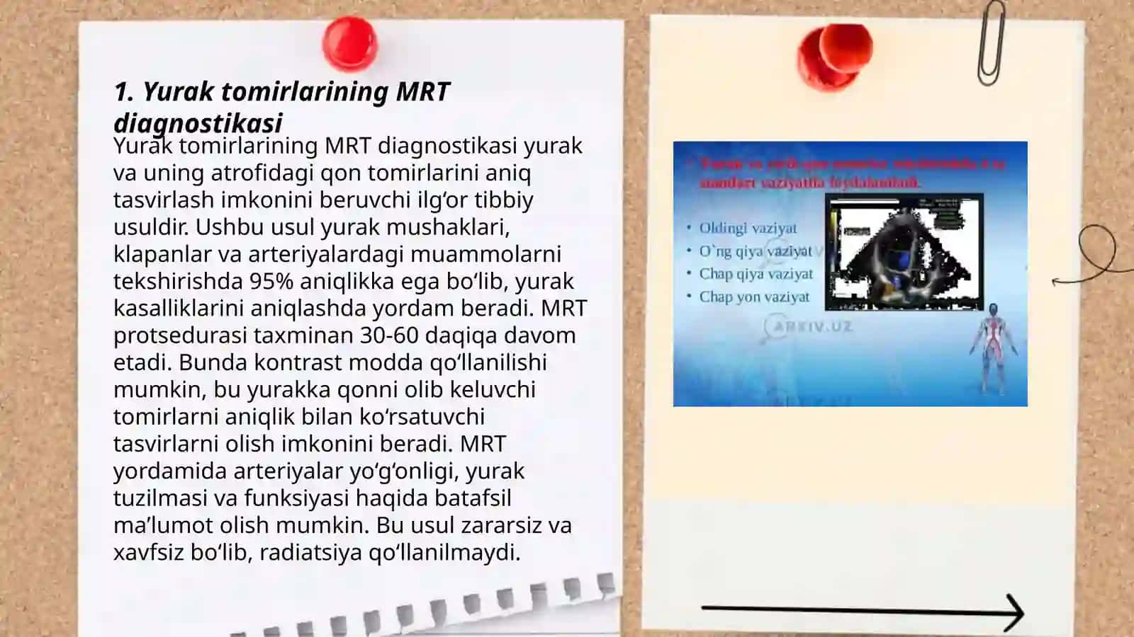 Yurak tomirlari va koʻks oraligʻi organlarining kasalliklarida nur tashxisoti( yurak kasalliklari) MRT. MCT. Rentgen diagnostikasi 3