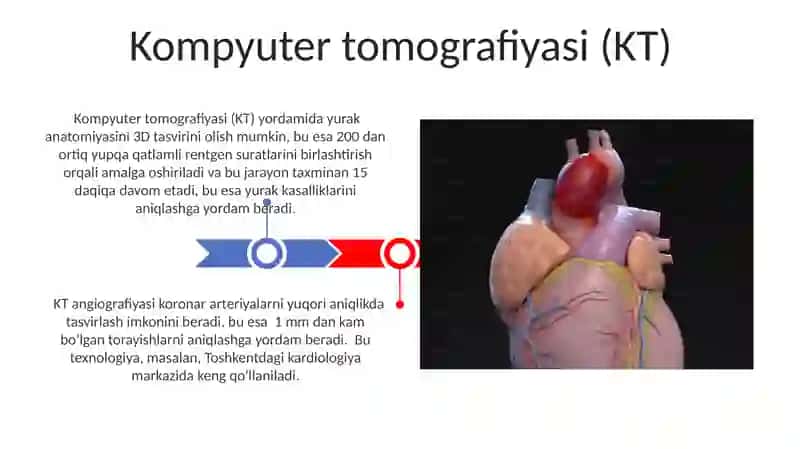 Yurak va qon- tomir nurli tekshirish usullari 3