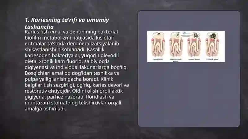 Karies haqida tushuncha 3