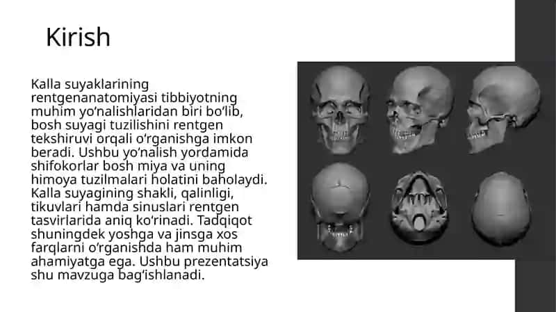 Kalla suyaklarining rentgenanatomiyasi. Kalla suyagining yoshi va jinsiy tafovutlari 3