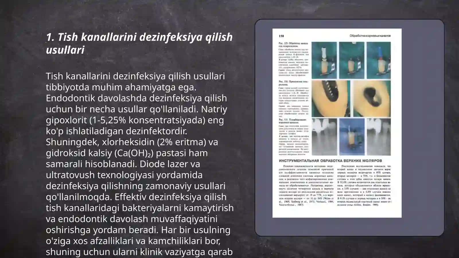 Konservativ endodontiya 3