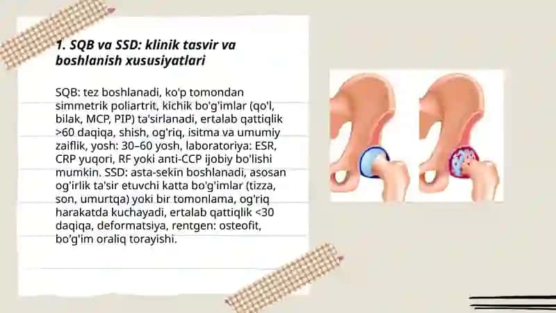 Bo'g'im kasalliklar differentsial diagnostikasi(SQB, SSD, RA, DOA) 3