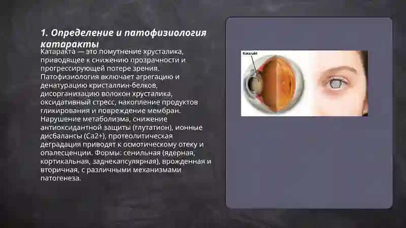 Катаракта 3