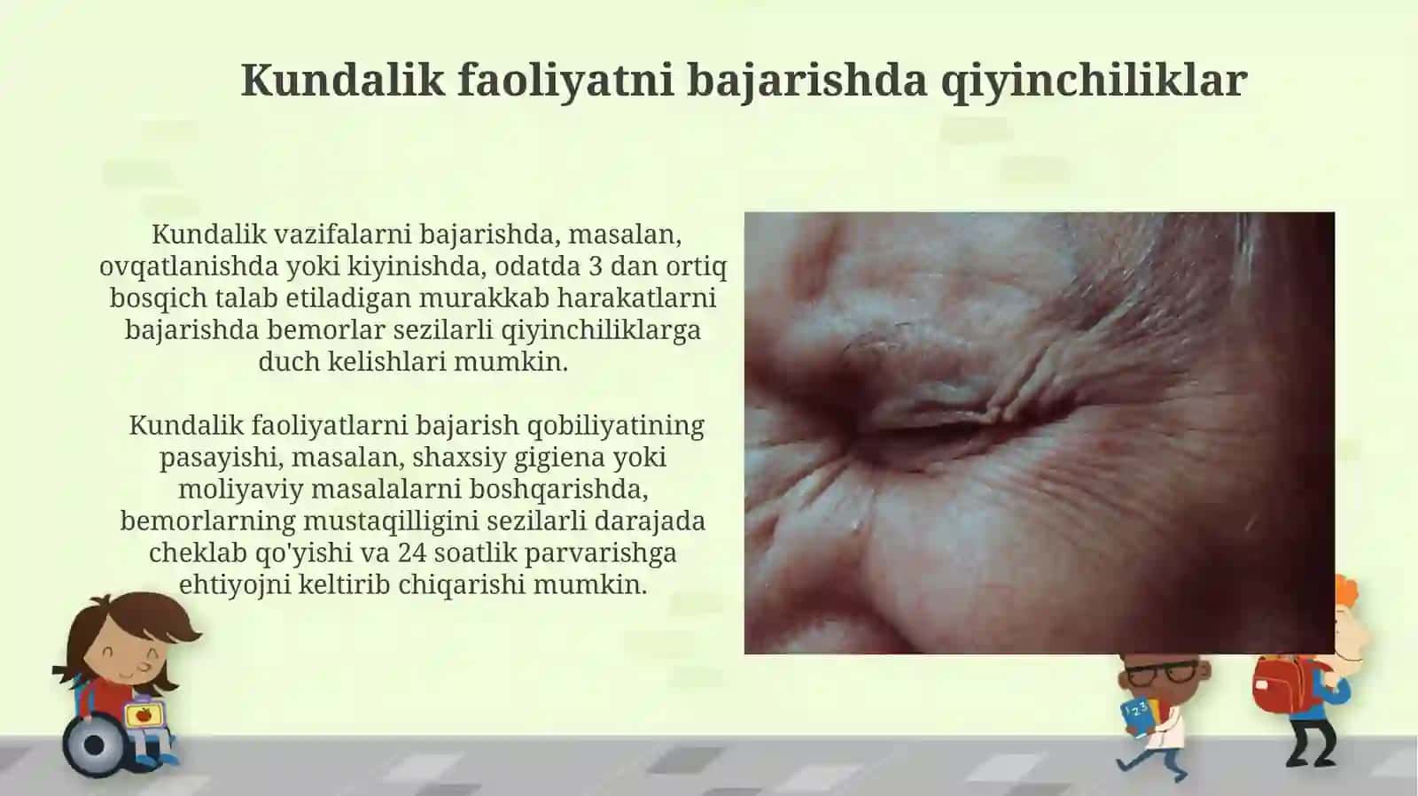 Demensiya: klinik ko‘rinishdagi demensiyaning xususiyatlari 3
