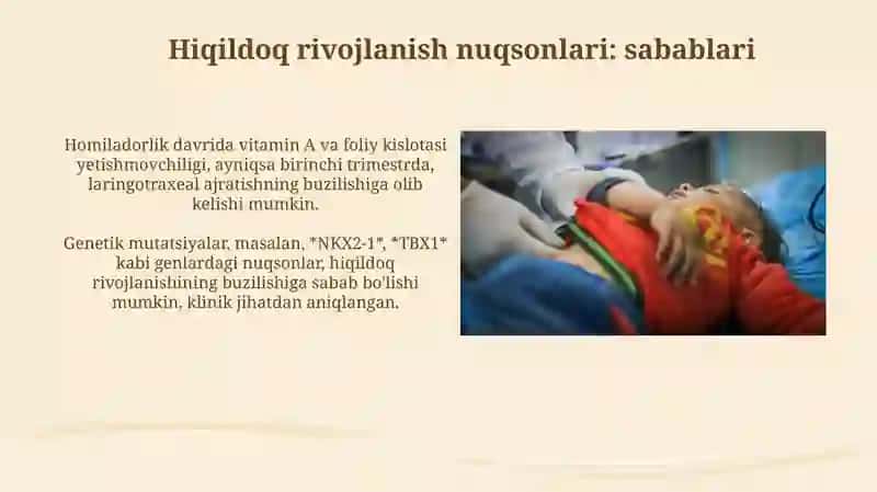 Hiqildoq rivojlanish nuqsonlari: sabablari va patogenezi 3