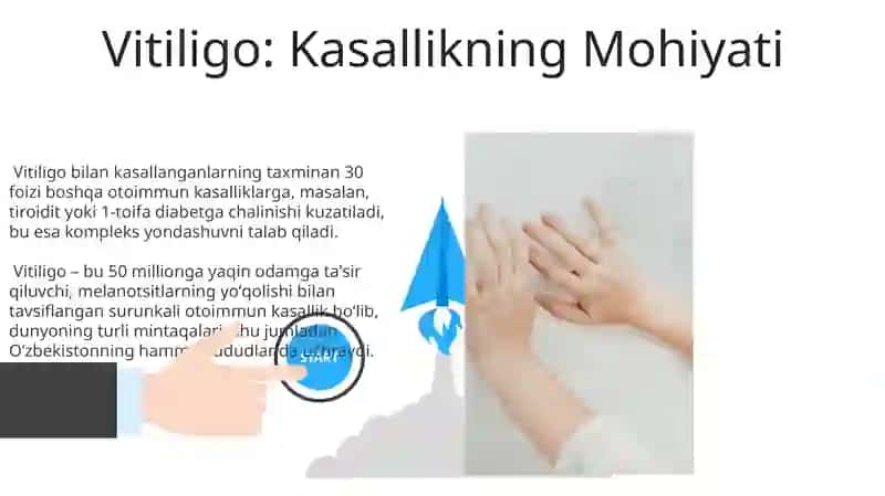Dermatomiozitlar. Vitiligoning zamonaviy davo usullari 3