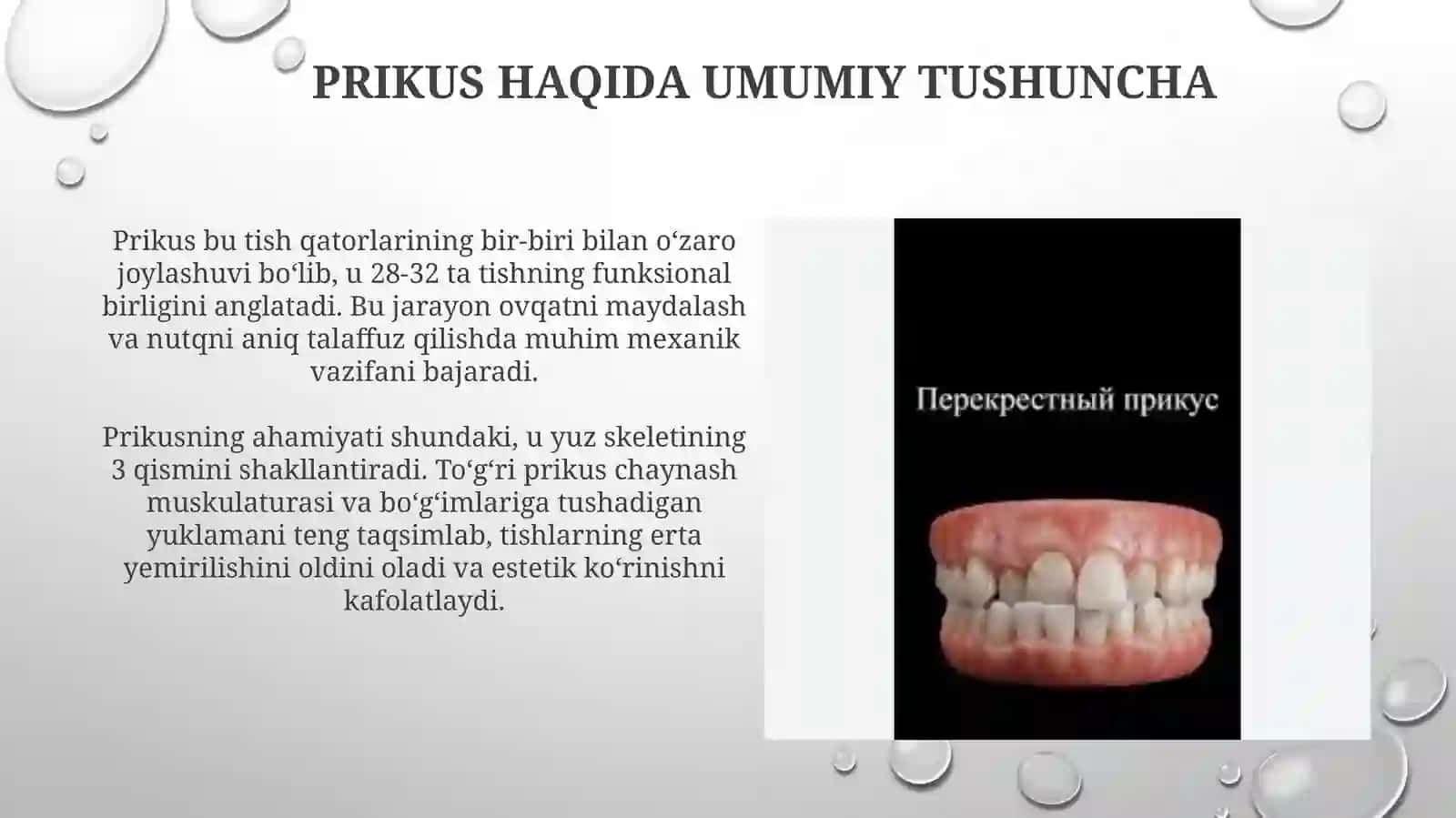 Prikus 3