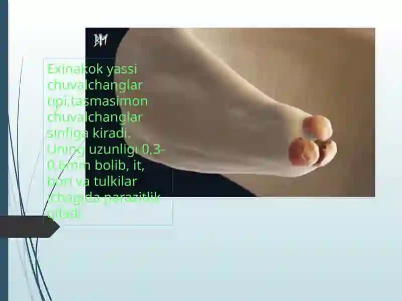Exinakok yassi chuvalchanglar 3