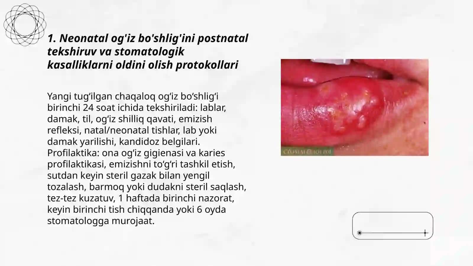 Neonatal og'iz bo'shlig'ini postnatal tekshiruv 3
