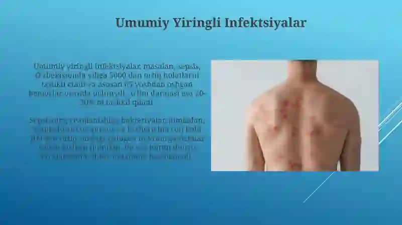 Umumiy Yiringli Infektsiyalar 3