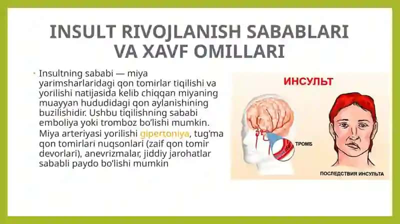 Insult sabablari, xavf omillari, belgilari, tashxis, davolash va oldini olish 3