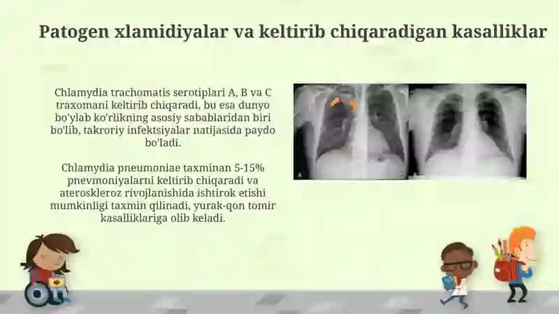 Xlamidiya va Mikoplazma Infektsiyalari 3