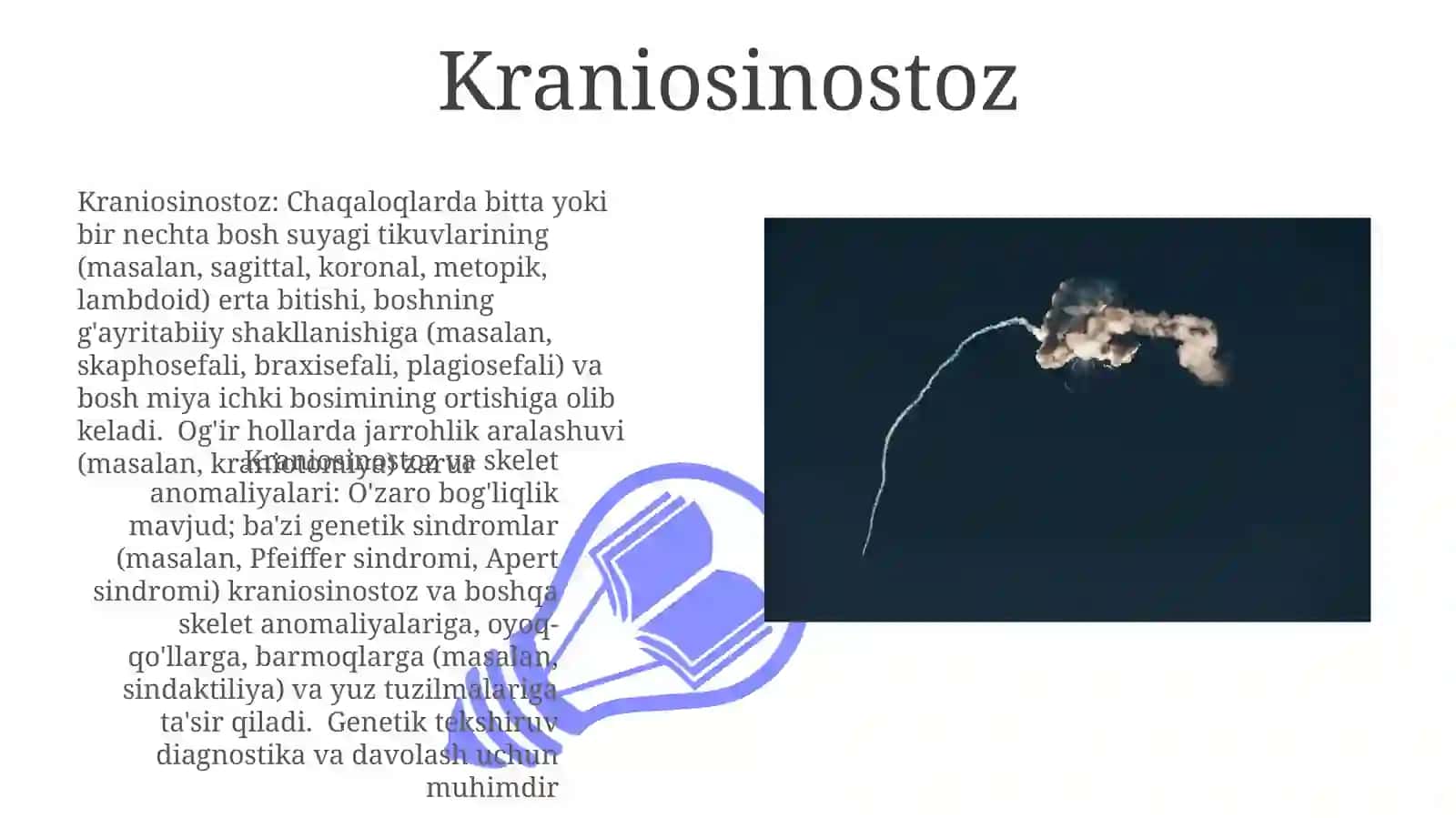 Skeletning rivojlanish anomaliyalari 3