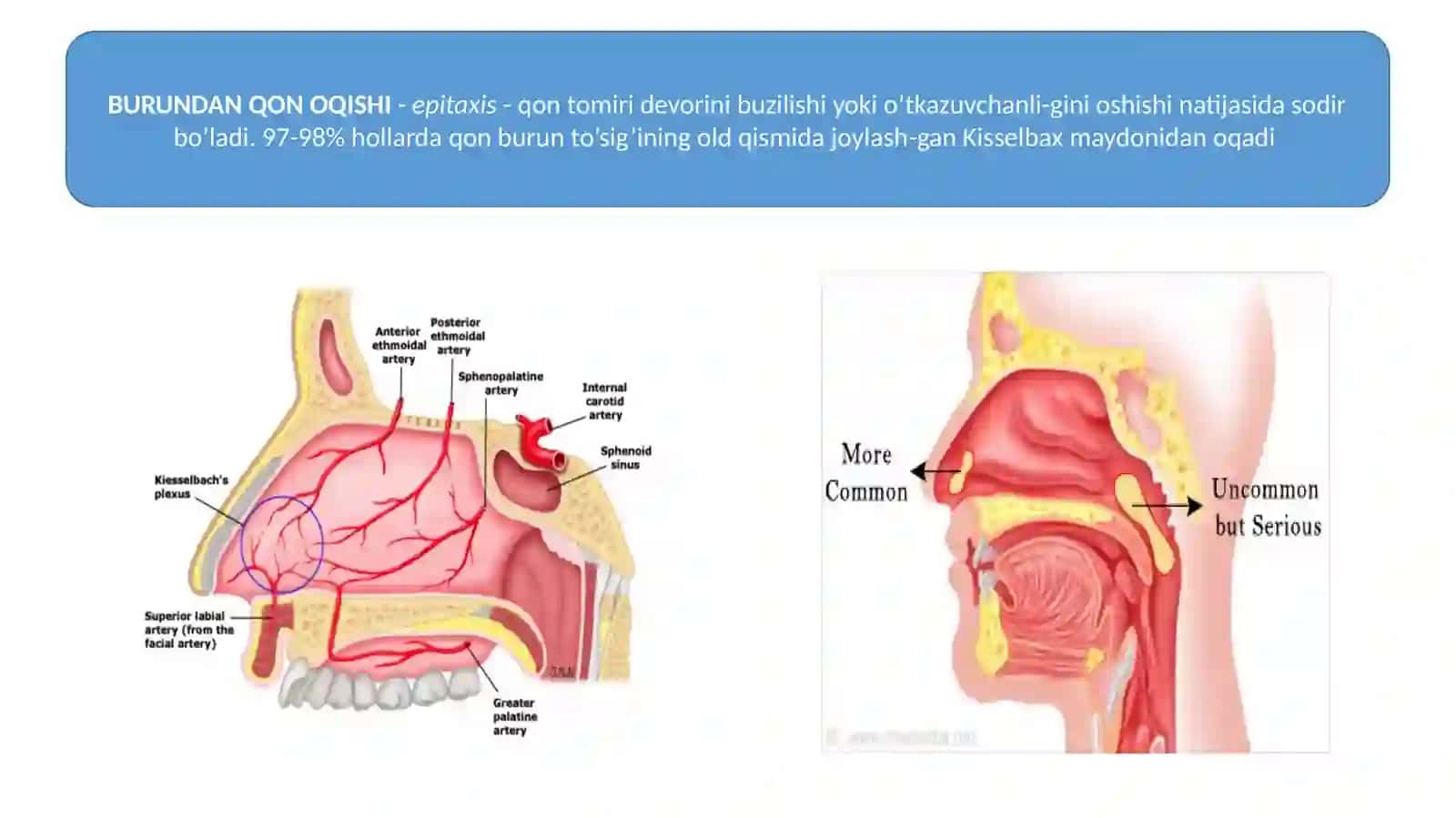Burun qonashi va uni to`xtatish usullari 3