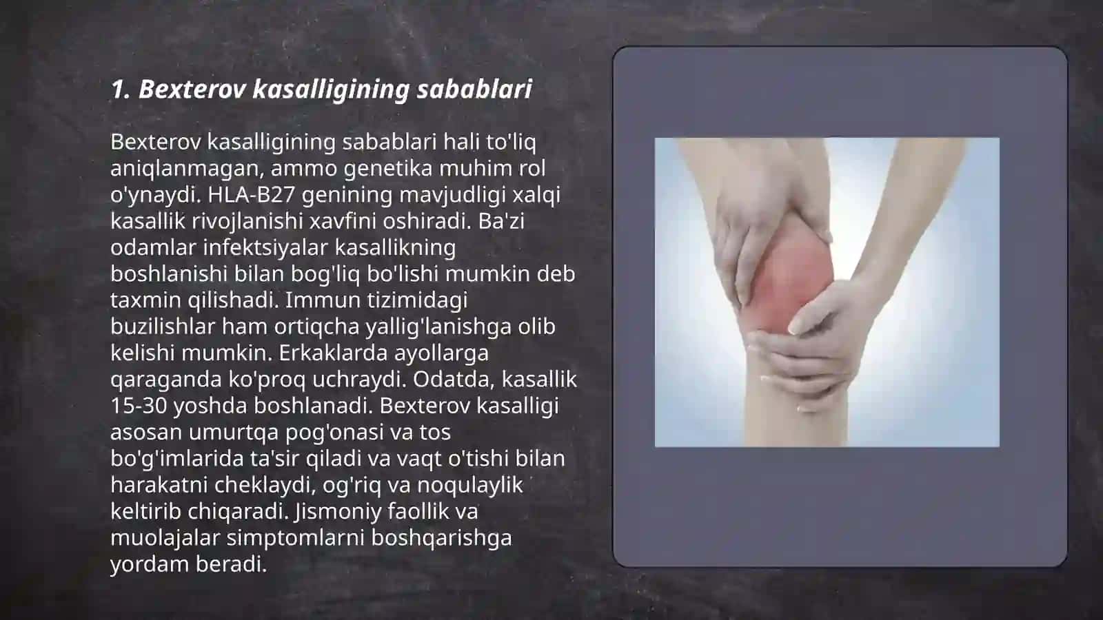 Bexterov kasalligi(autoimmun kasallik ) 3