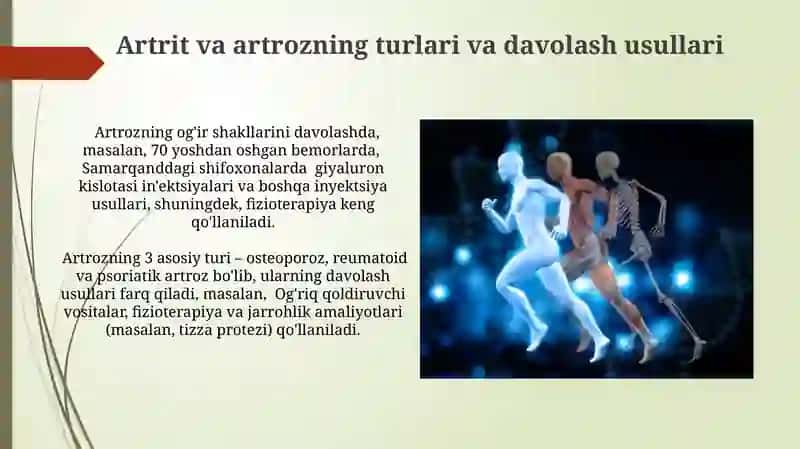 Artrit va artrozning turlari va davolash usullari 3