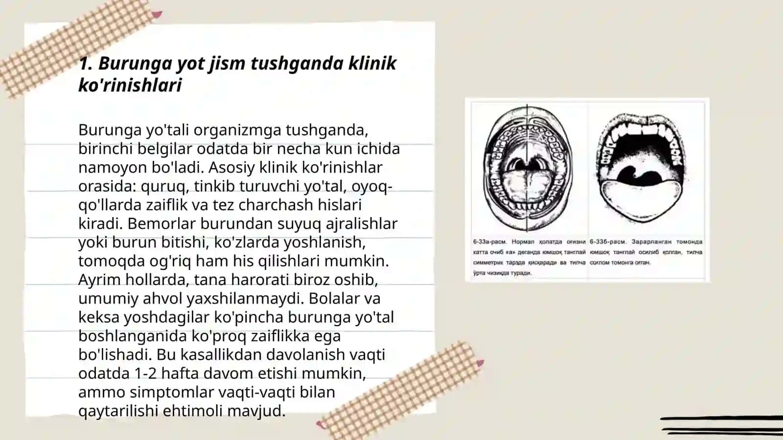 Burunga yot jism tushganda klinikasi,etiologiyasi, Differensial tashxis,va davolash 3