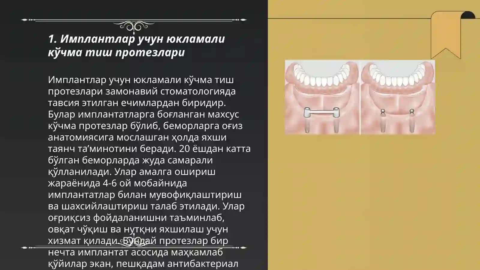 Имплантлар учун юкламали кўчма тиш протезлари 3