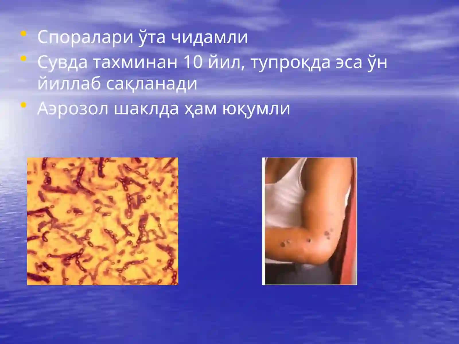 Куйдирги2 3