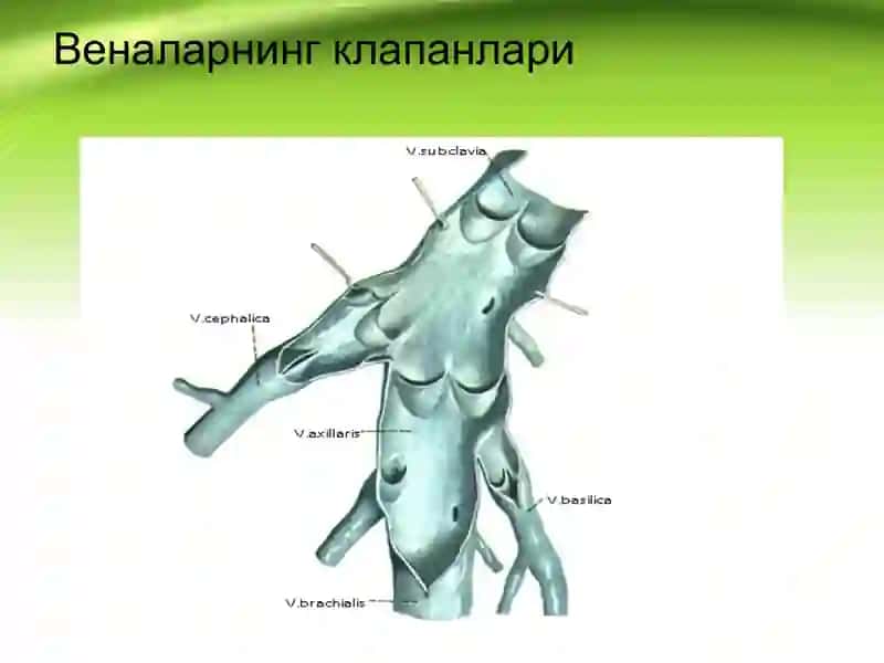 Оёқ веналарининг варикоз касаллиги Varikoz kasalligi 3