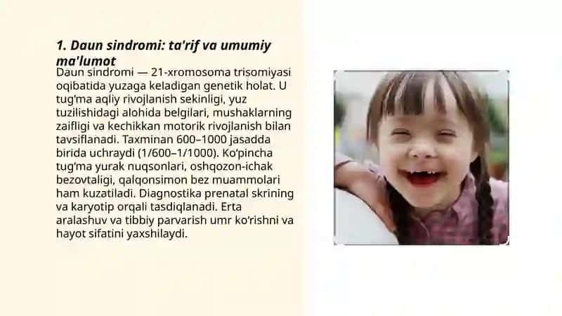 Daun sindromi 3