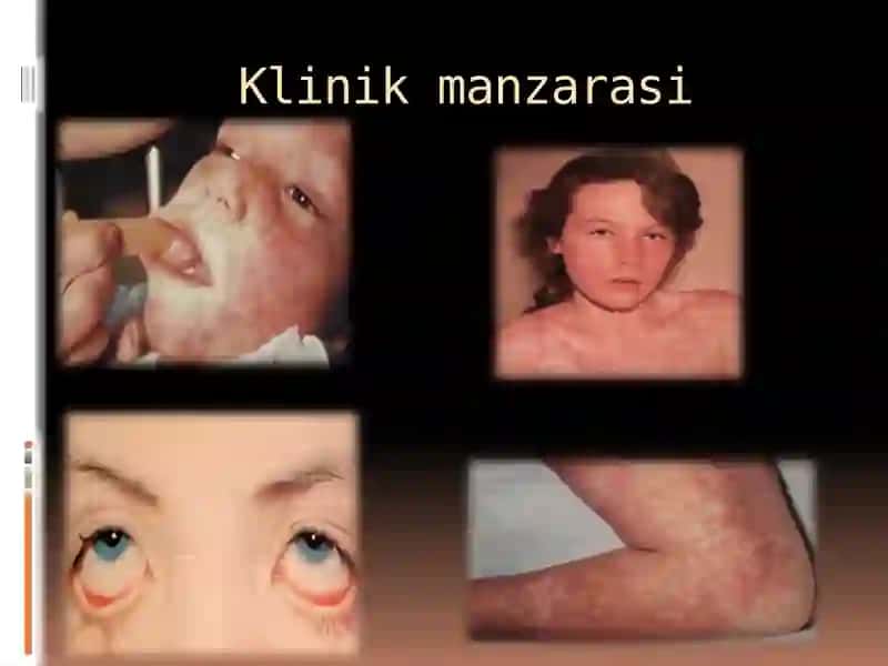 YUqumlivayuqumsizkasalliklar 3