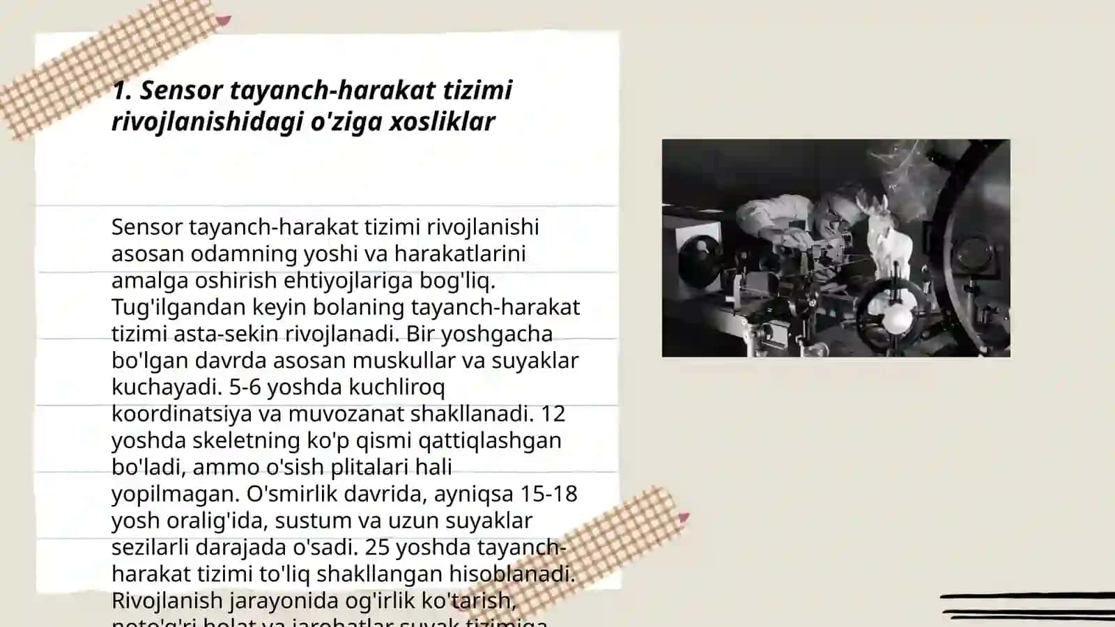 Sensor tayanch harakat intelekt va nutq buzulishlari 3