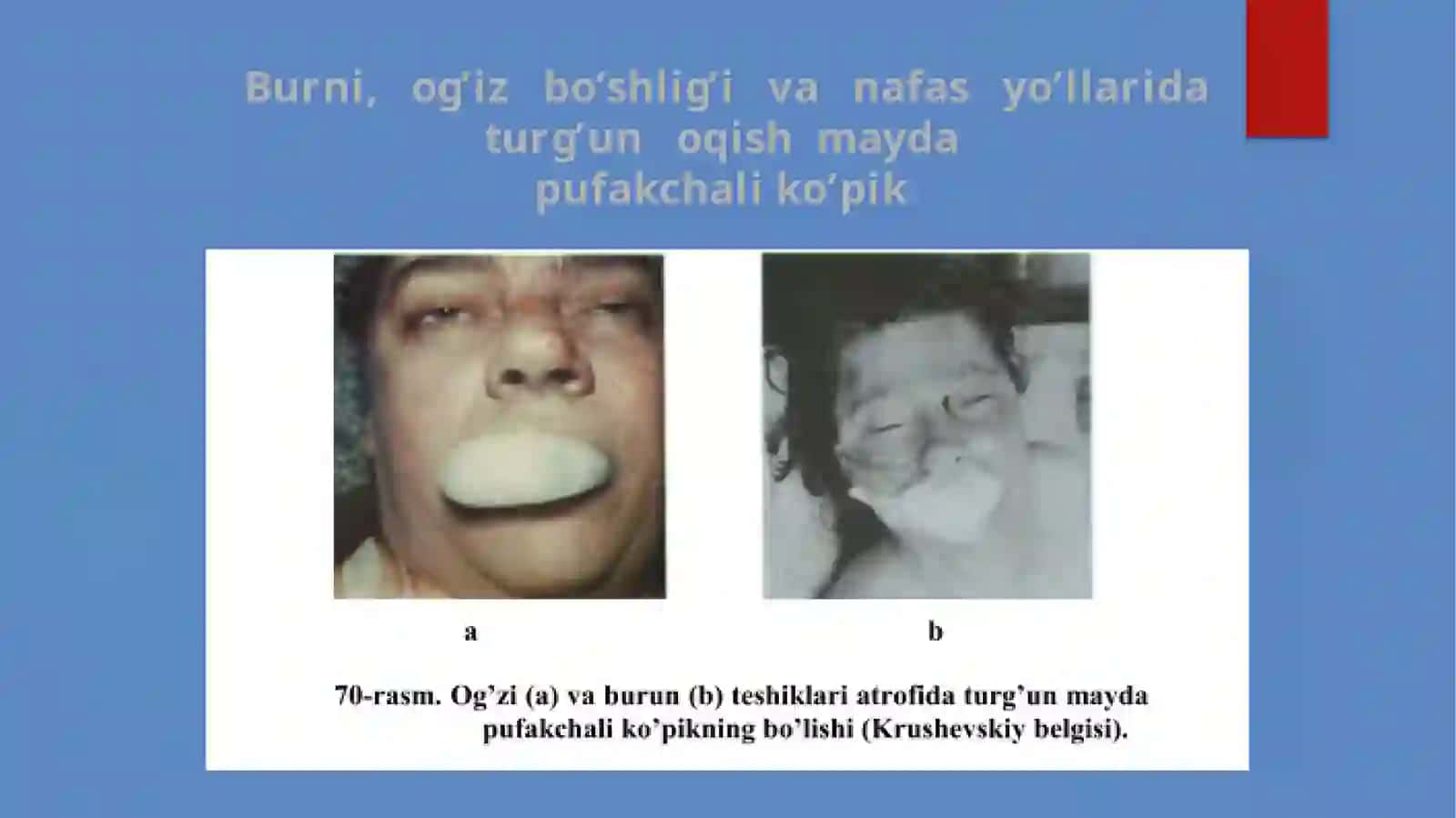 CHO‘KISHDA LABORATORIYA TEKSHIRUVI USULLARI 3