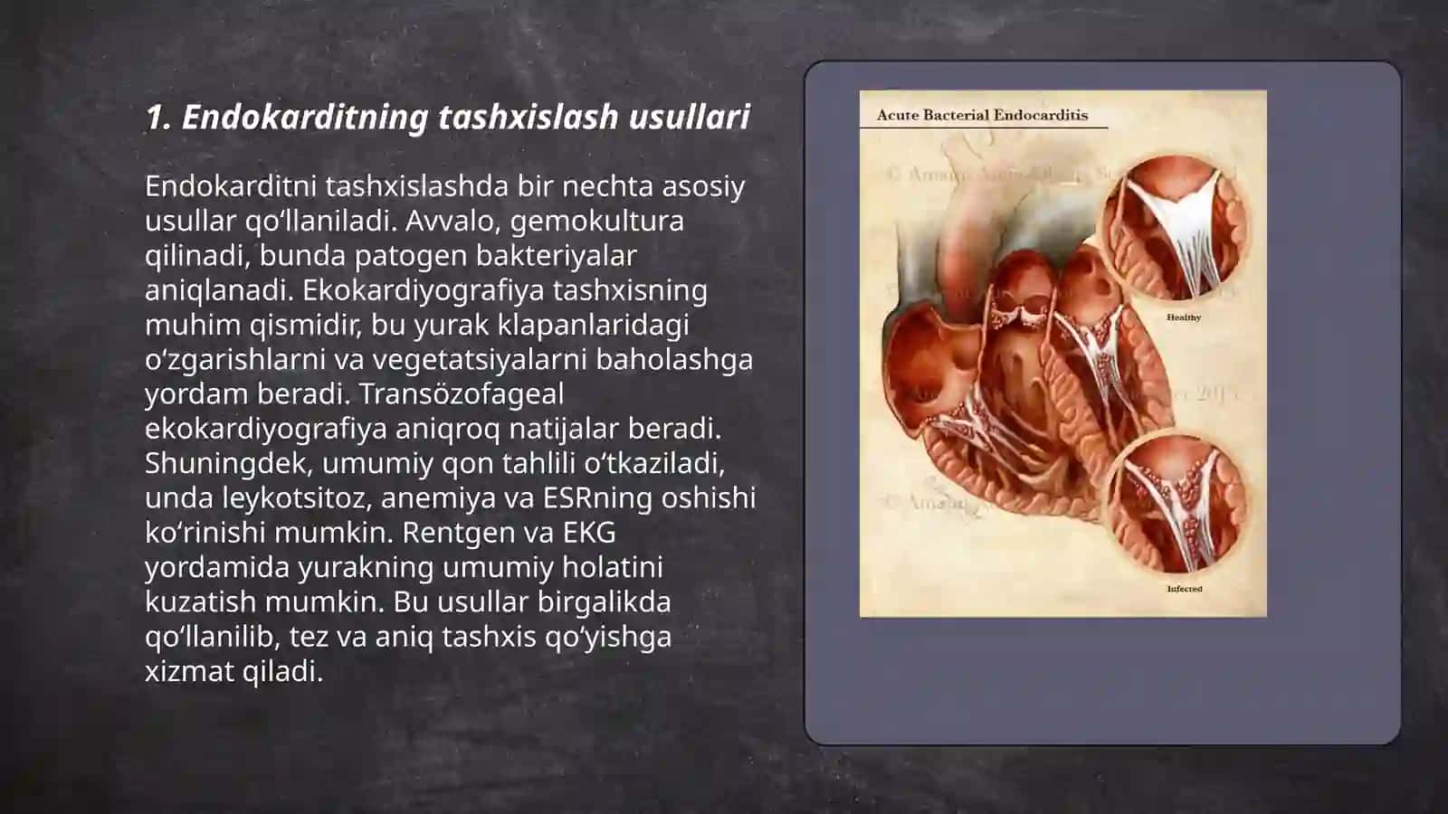 Infeksion endokardit 3