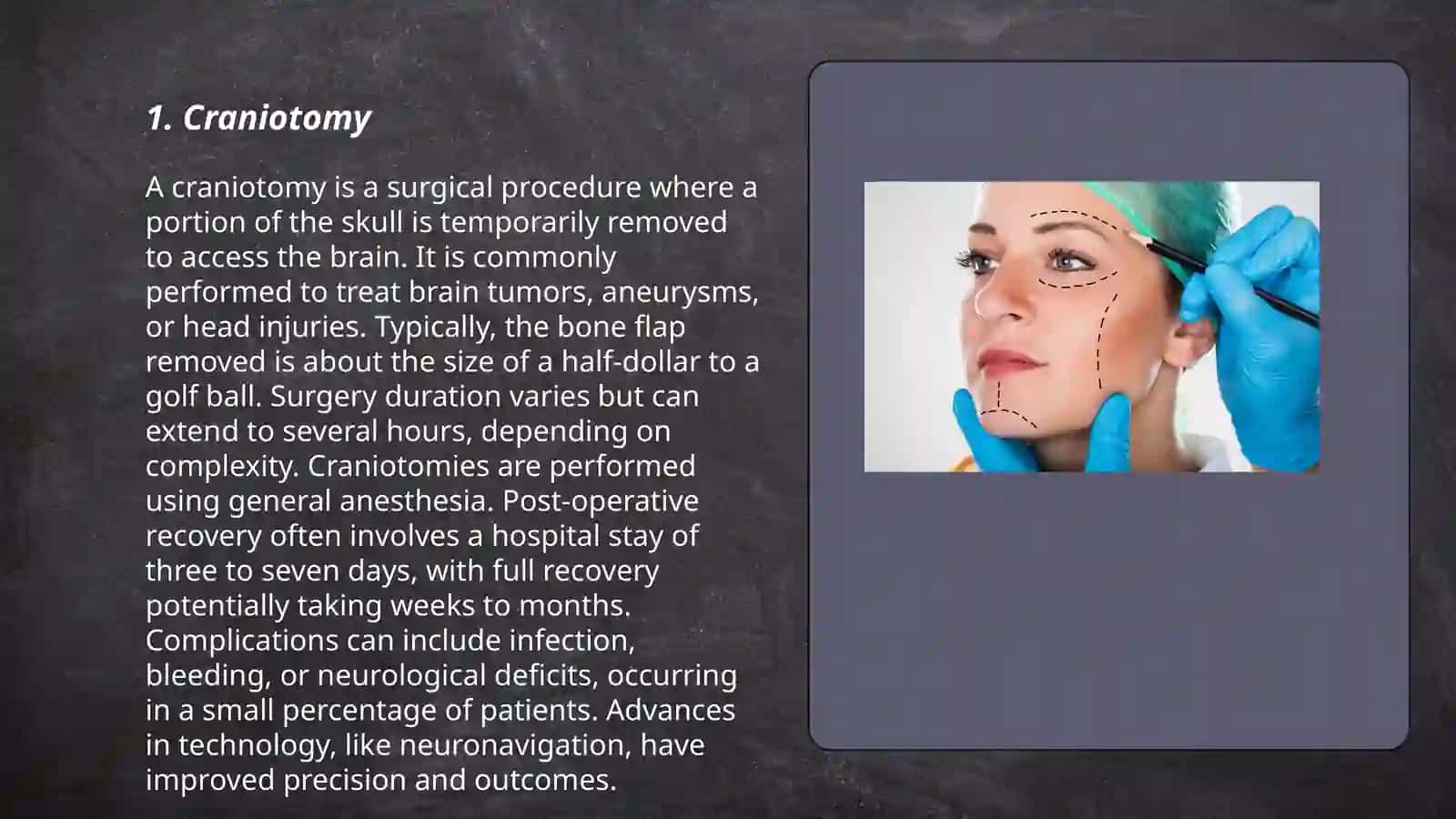 Head surgery 3