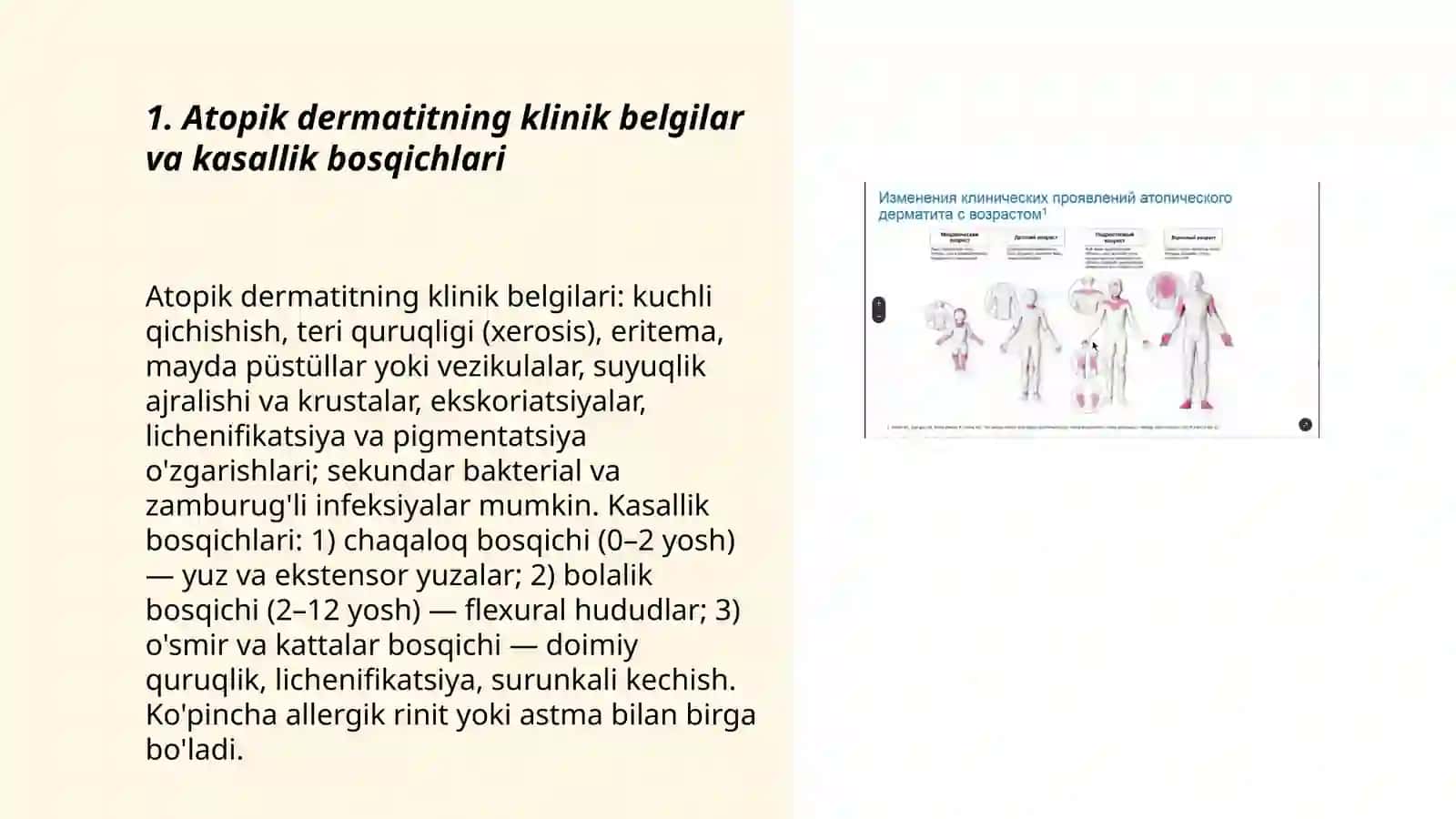 Atopik dermatit klinikasi, tekshirish va davolash usullari 3