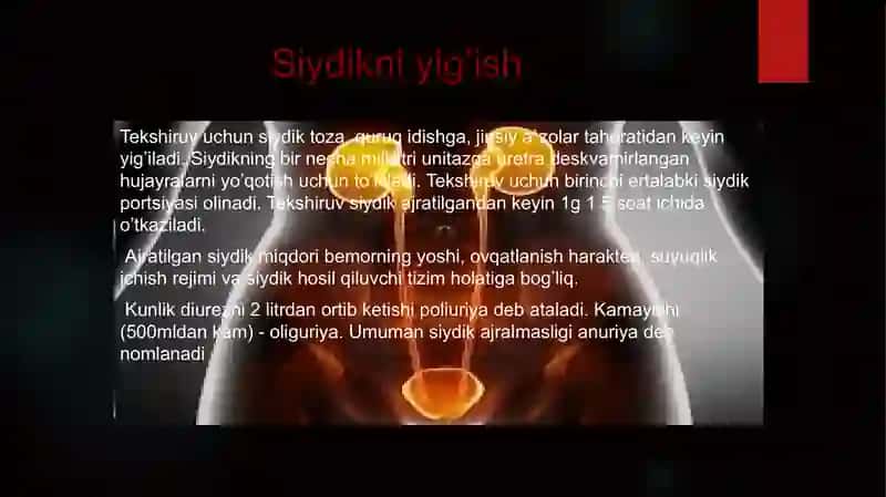 Siydik umumiy tahlili 3