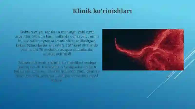 Salmonellezlar epidemiologiyasi profilaktikasi 3