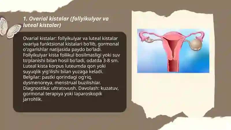 Ginekologik kasalliklar va kistalar 3