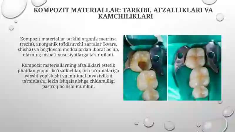 Stomatologiyada kompozit materiallar 3