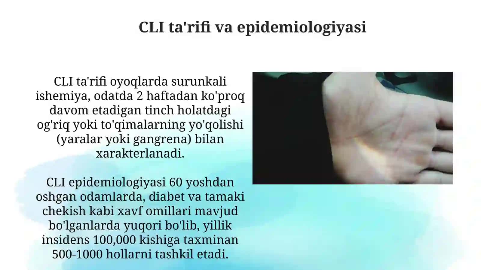 Tanqidiy oyoq ishemiyasining ta'rifi va sabablari  Diagnostika va baholash  . Davolash usullari va prognoz 3
