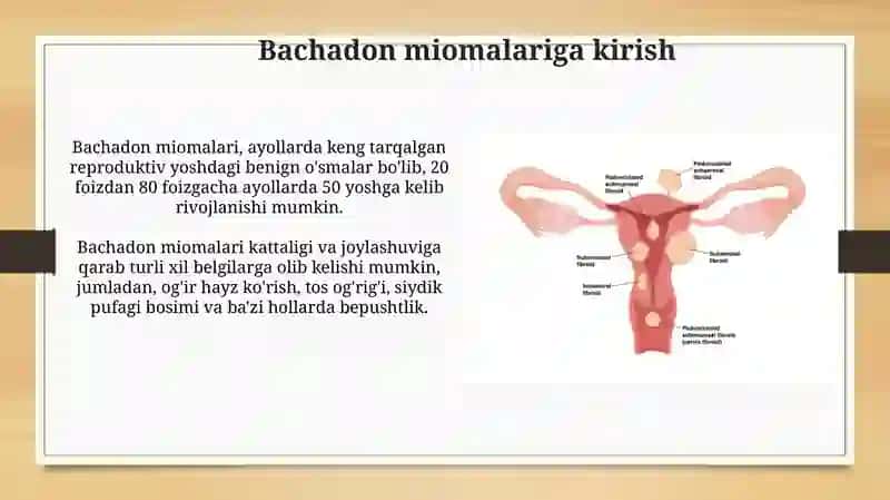 Bachadon miomasi. Endometrioz. Bachadon miomasi tasnifi. 3