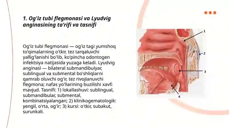Og’iz tubi flegmonasi. Lyudvig anginasi 3