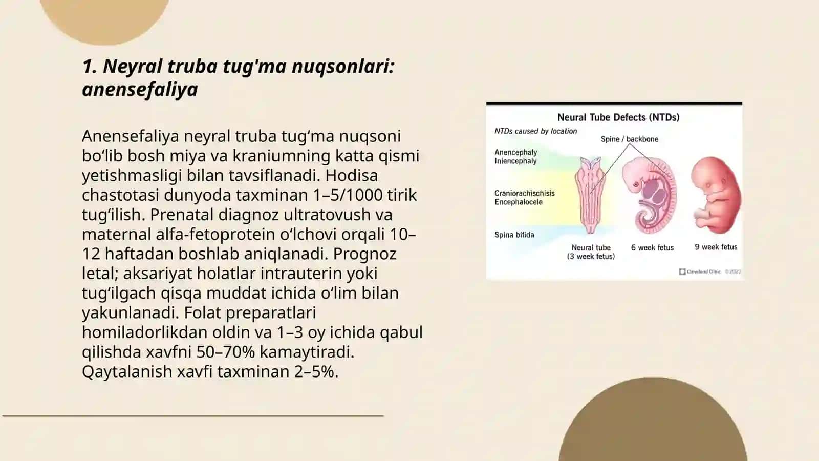Anensefaliya Neyral truba tug'ma nuqsonlari 3