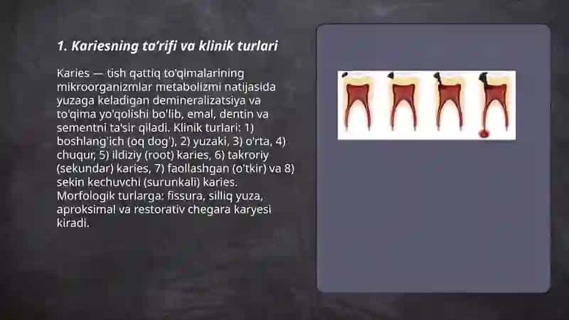 Karies etiologiyasi, patogenezi va uning yoshga oid belgilari 3