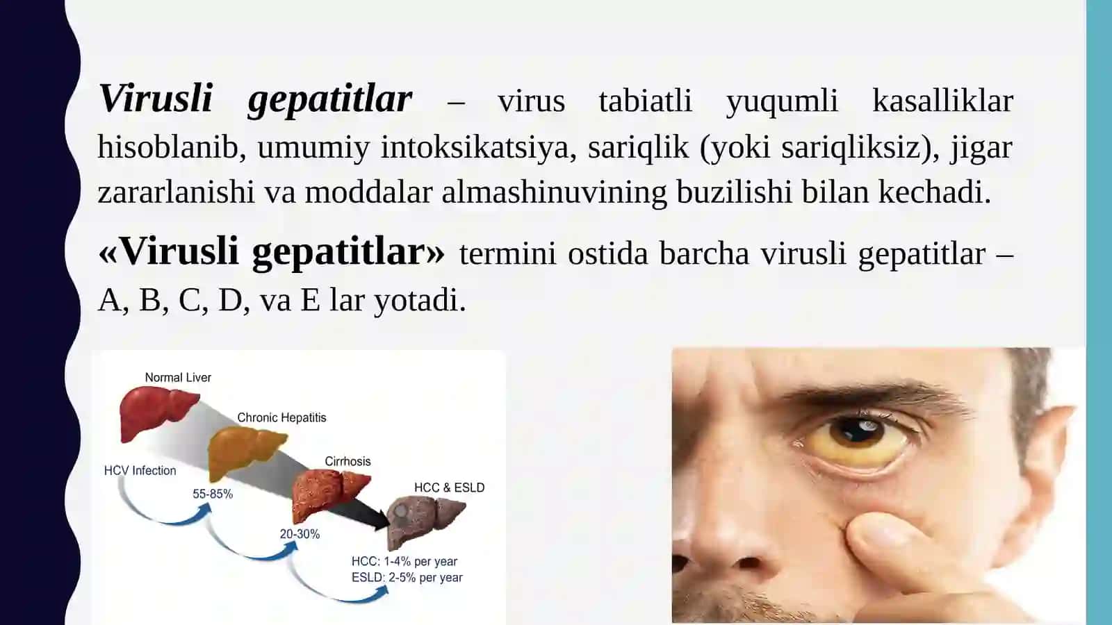 Gepatitlar 3